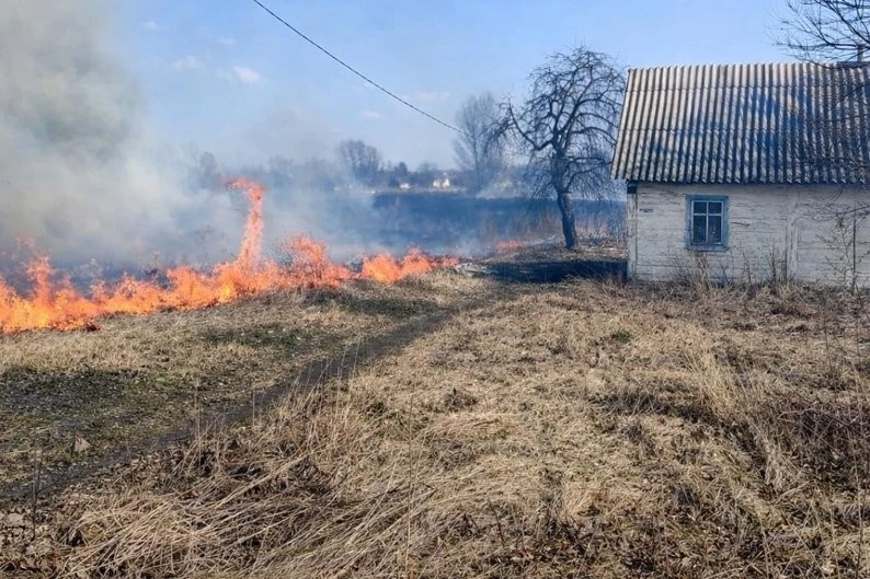 На Житомирщині вогонь на відкритій місцевості забрав здоров’я чоловіка